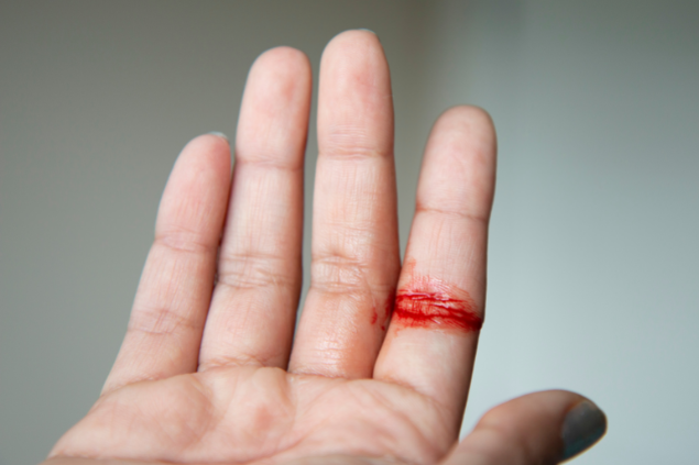 Mão com pequeno sangramento em um dos dedos.