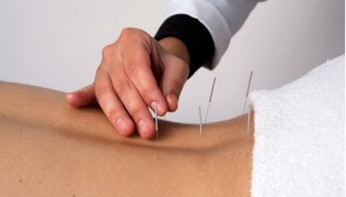 Medo de agulhas e os benefícios da acupuntura