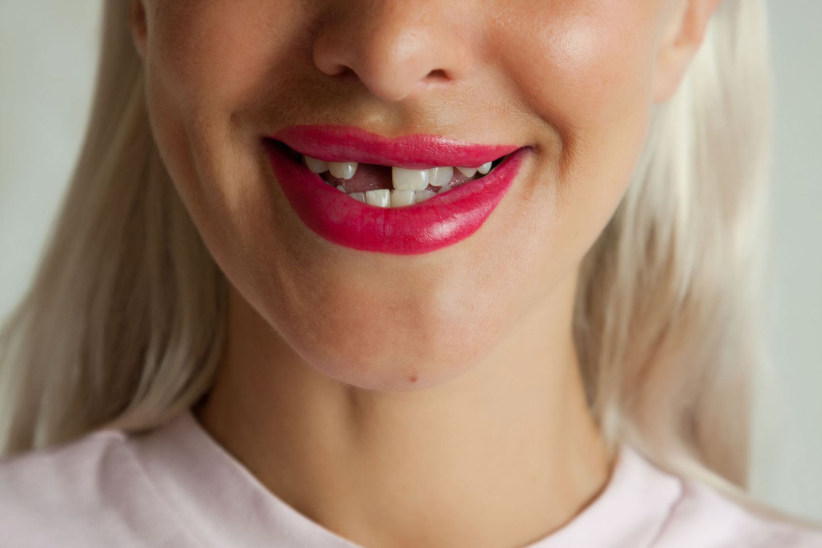 Sonhar com dente furado é ruim? Analise esse sonho!