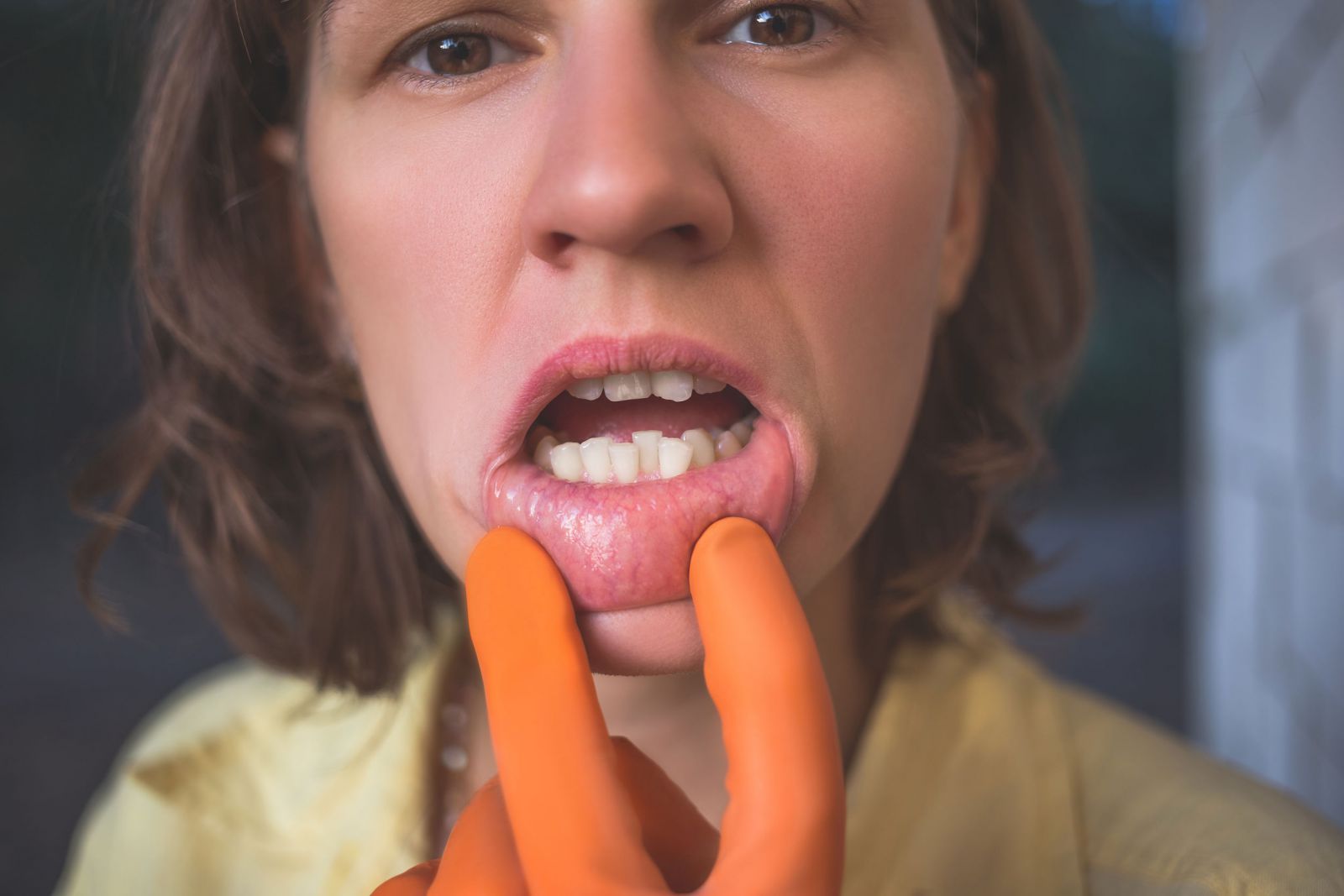 Mulher segurando seu lábio mostrando seus dentes