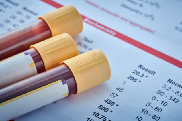 Vários testes de sangue em tubos