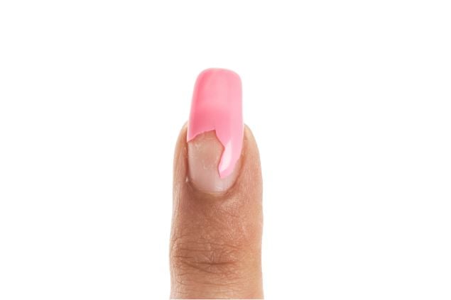Unha do dedo indicador da mão quebrada