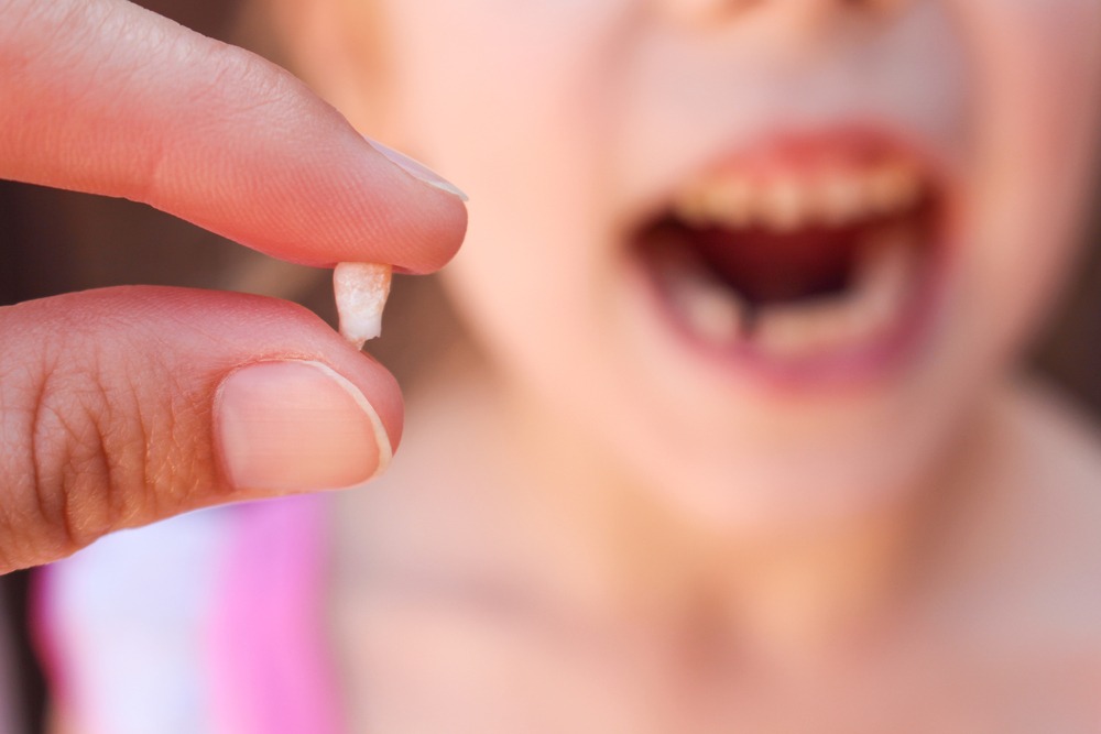 Um dente que foi arrancado de uma criança sendo segurado por dois dedos